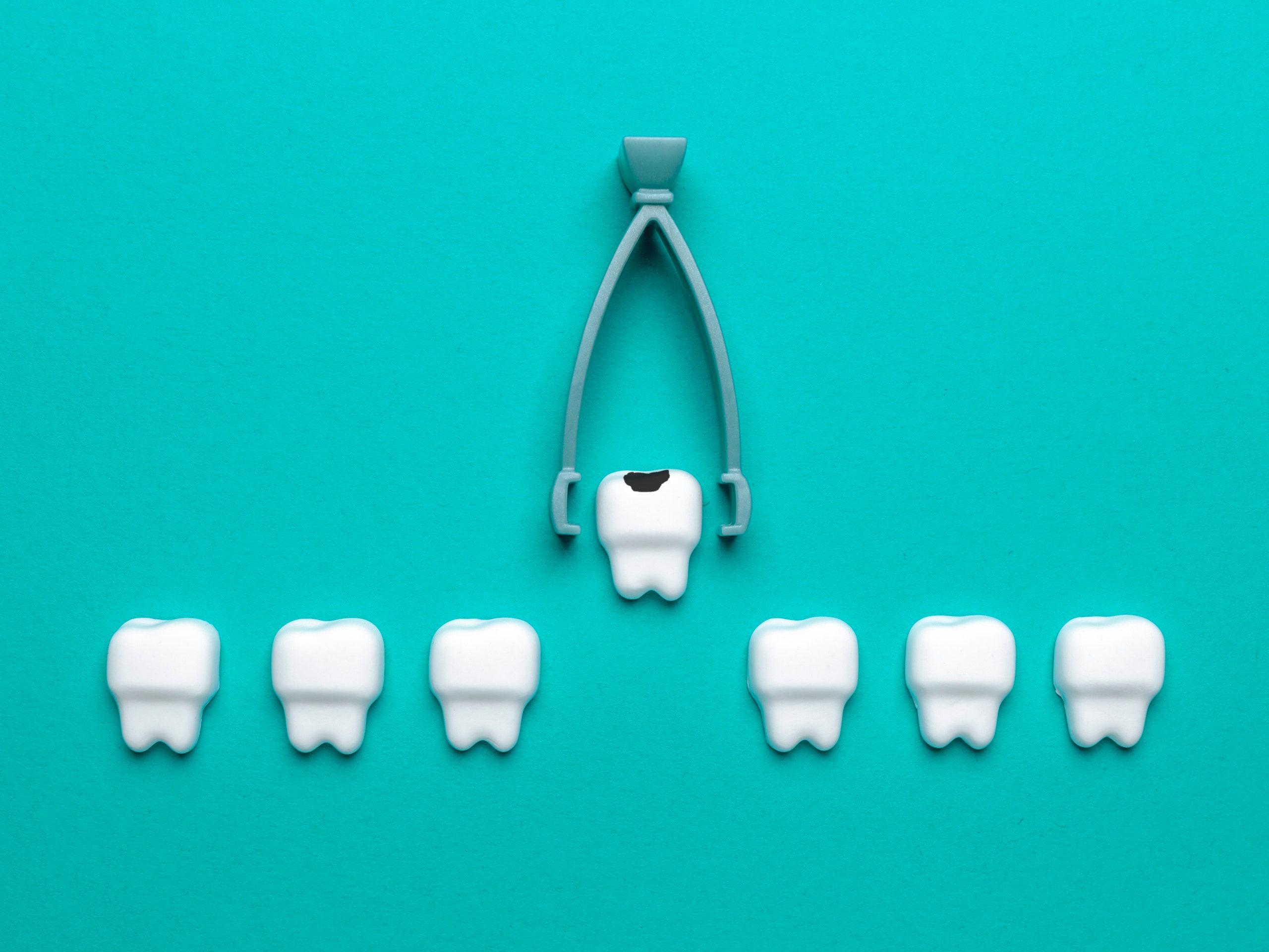 CAN I BRUSH MY TEETH AFTER A WISDOM TEETH EXTRACTION?